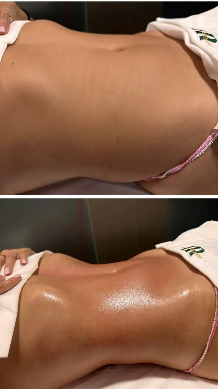 Before and after — session 2