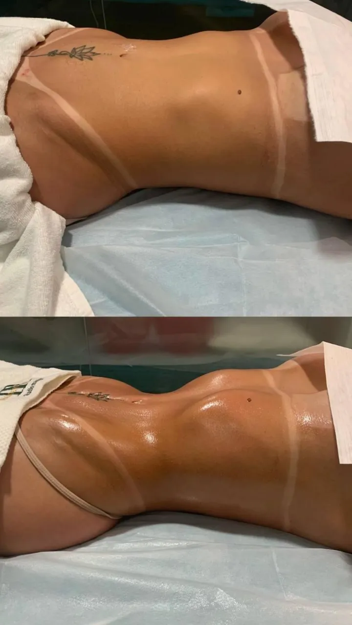 Before and after — session 3