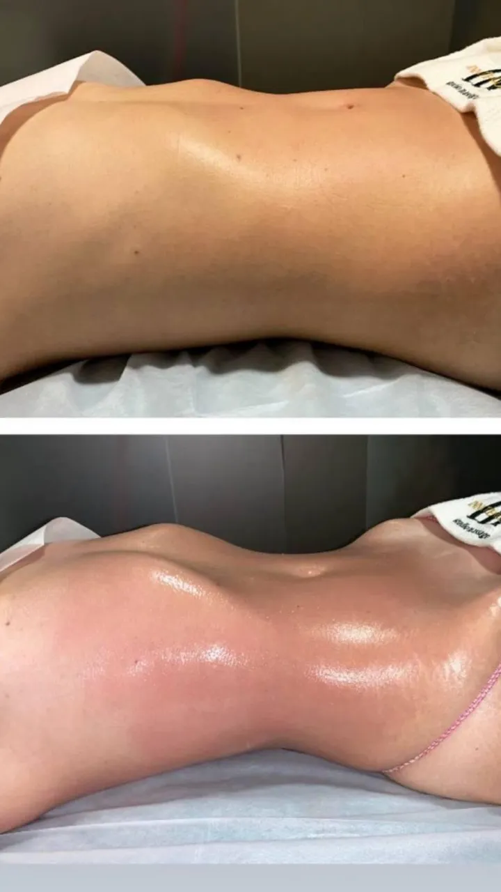 Before and after — session 5