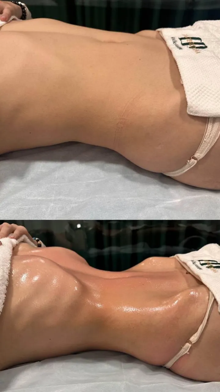 Before and after — session 6