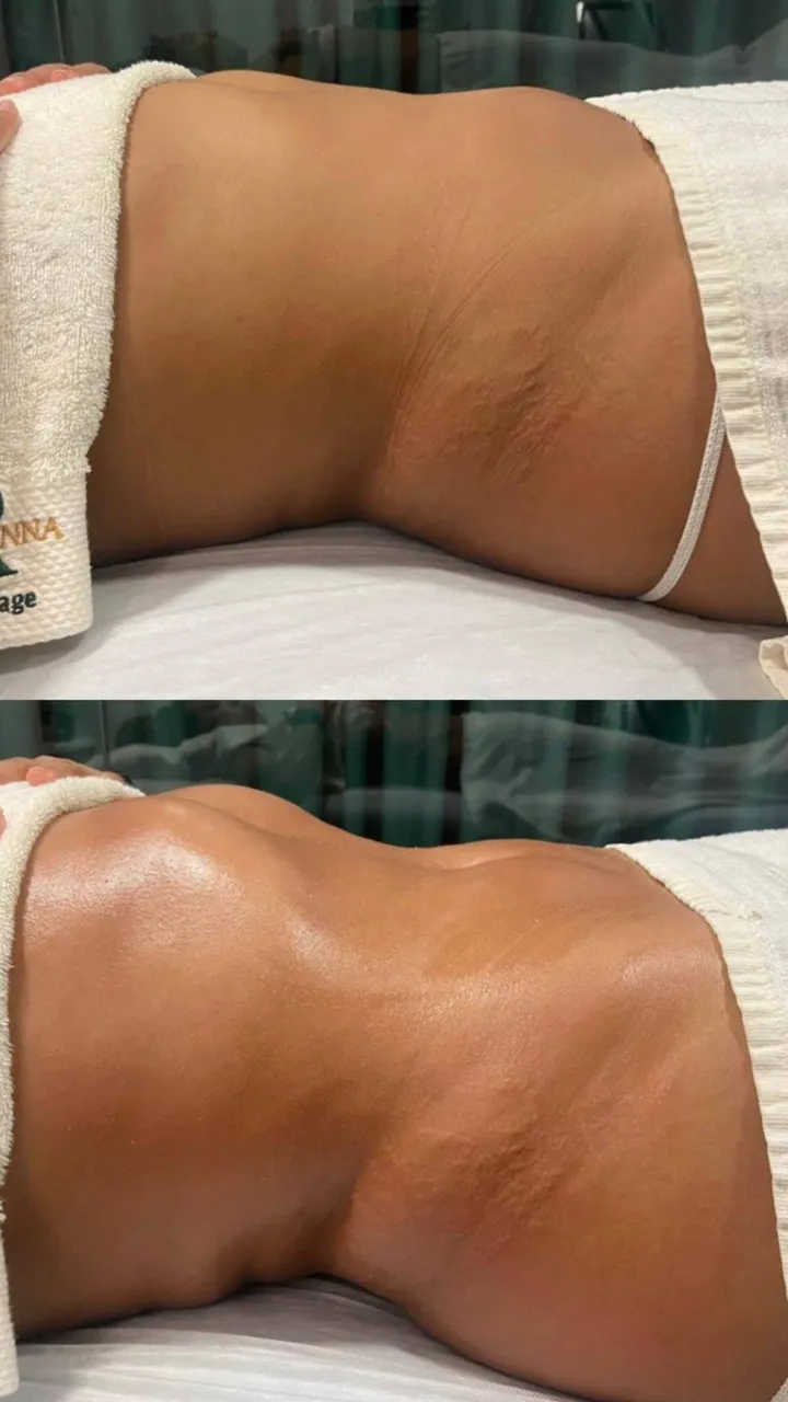 Before and after — session 9