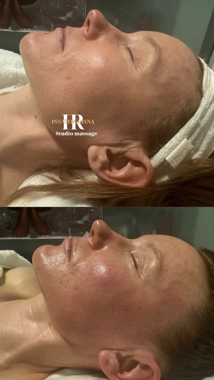 Before and after — session 11