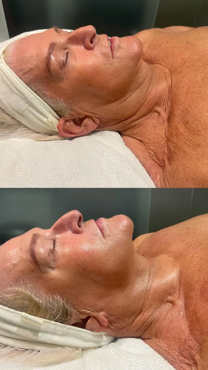 Before and after — session 12